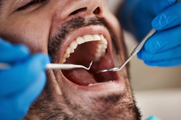 Best Urgent Dental Care for Toothaches in Rossmoor, NJ